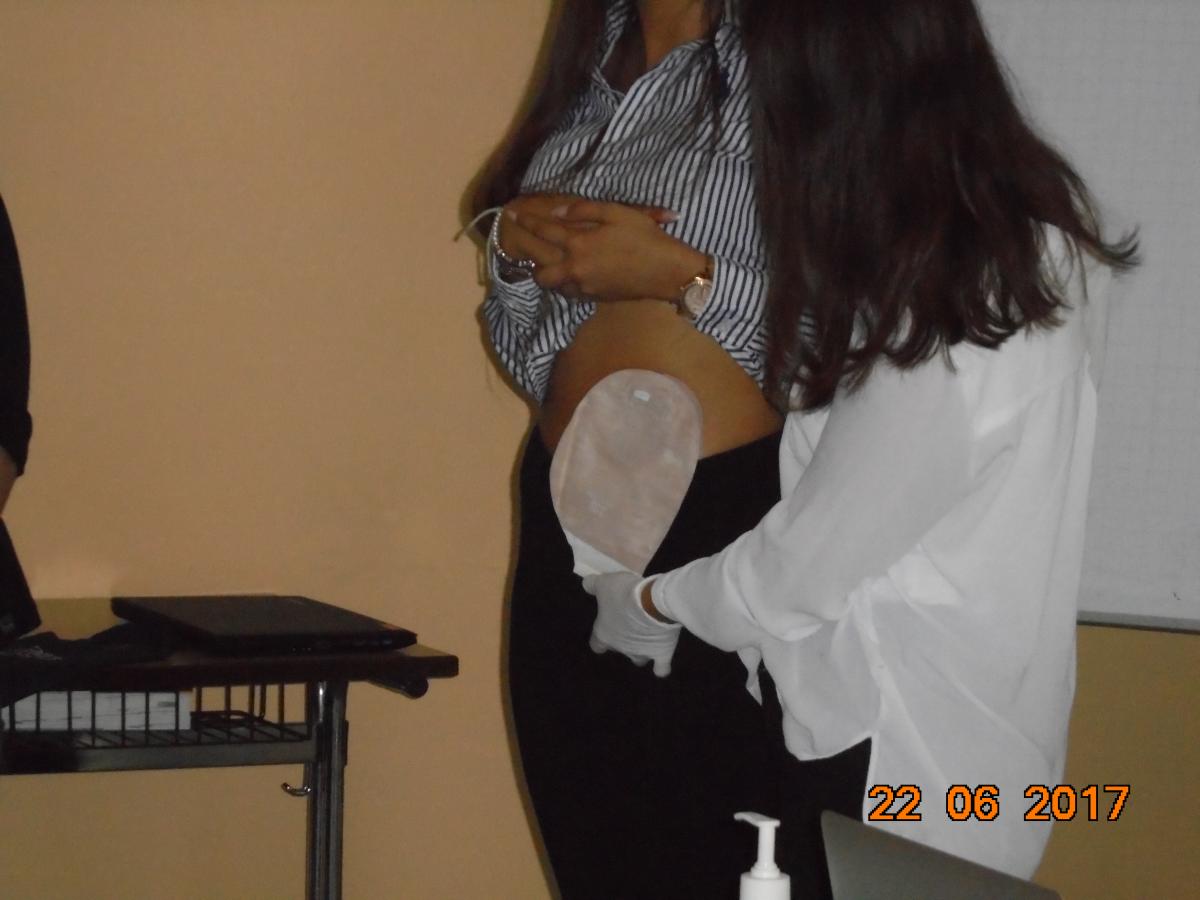 	Und fertig ist das.. ähm und fertig ist der Stomaversorgungswechsel